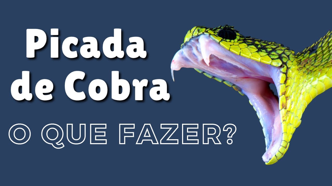 Picada de cobra: saiba o que fazer e o que não fazer